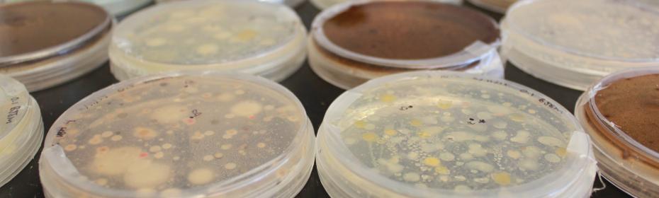 Plates of bacteria 